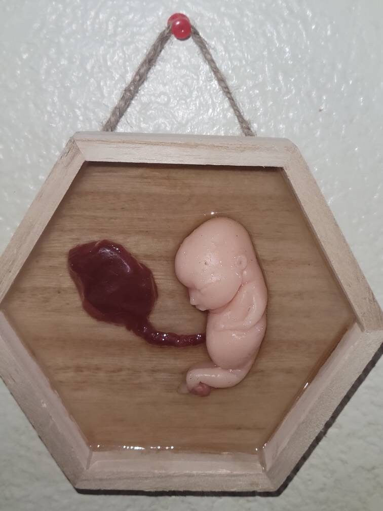 Silicone fetus memorial wall art
