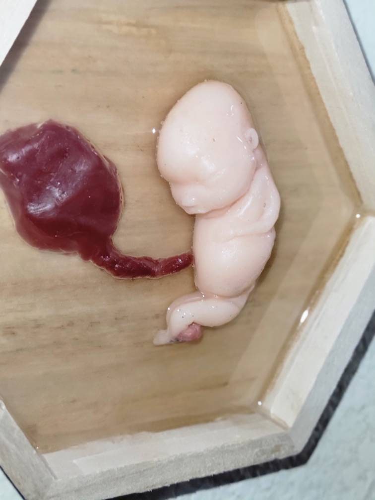 Silicone fetus memorial wall art