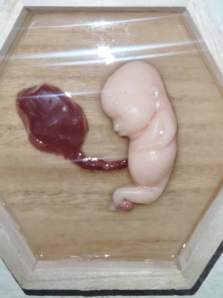 Silicone fetus memorial wall art