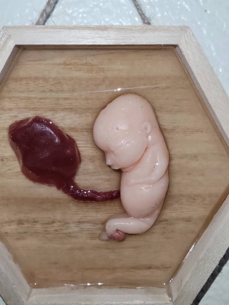 Silicone fetus memorial wall art