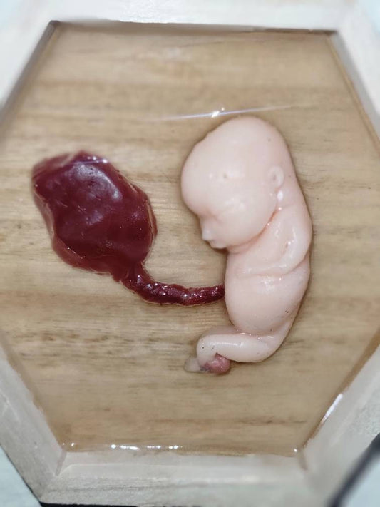 Silicone fetus memorial wall art
