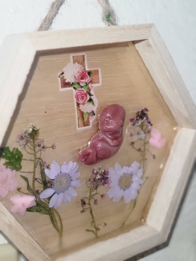 Ready to ship 11 week silicone fetus in beautiful wood frame with resin back drop