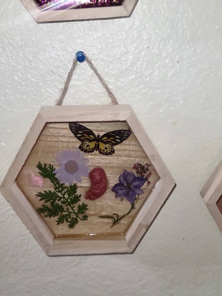 Ready to ship 10 week old silicone fetus in Beautiful wood frame with resin background