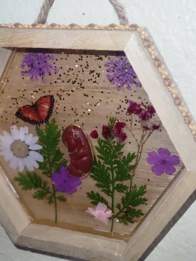 Ready to ship 10 week gestation silicone fetus in Beautiful wood frame with resin back ground
