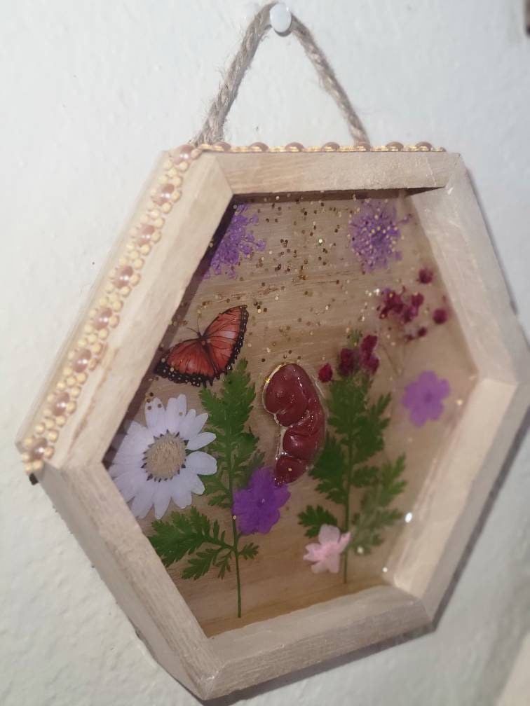 Ready to ship 10 week gestation silicone fetus in Beautiful wood frame with resin back ground