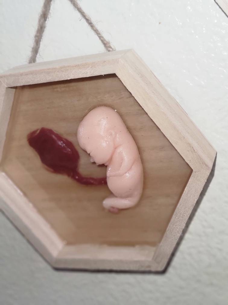 Silicone fetus memorial wall art