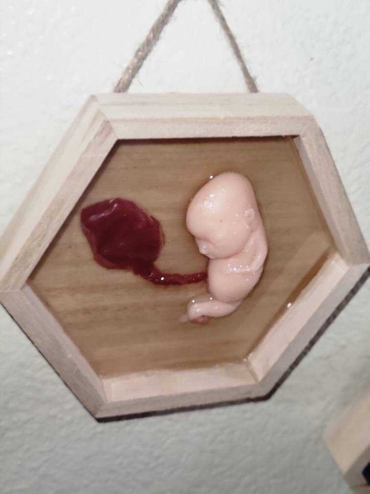 Silicone fetus memorial wall art