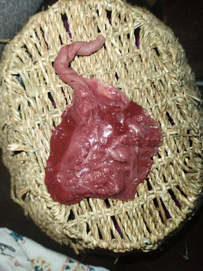 Silicone placenta and umbilical cord for silicone baby
