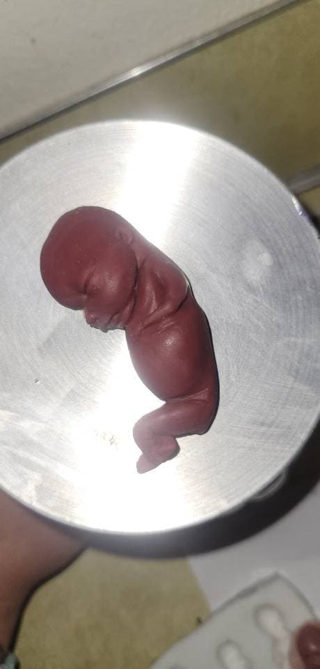 13 week gestational silicone memorial fetus RED