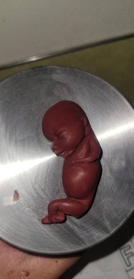 13 week gestational silicone memorial fetus RED