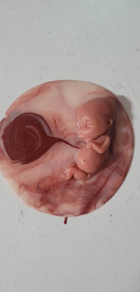 12 week gestational fetus silicone memorial baby inside silicone womb with placenta attached
