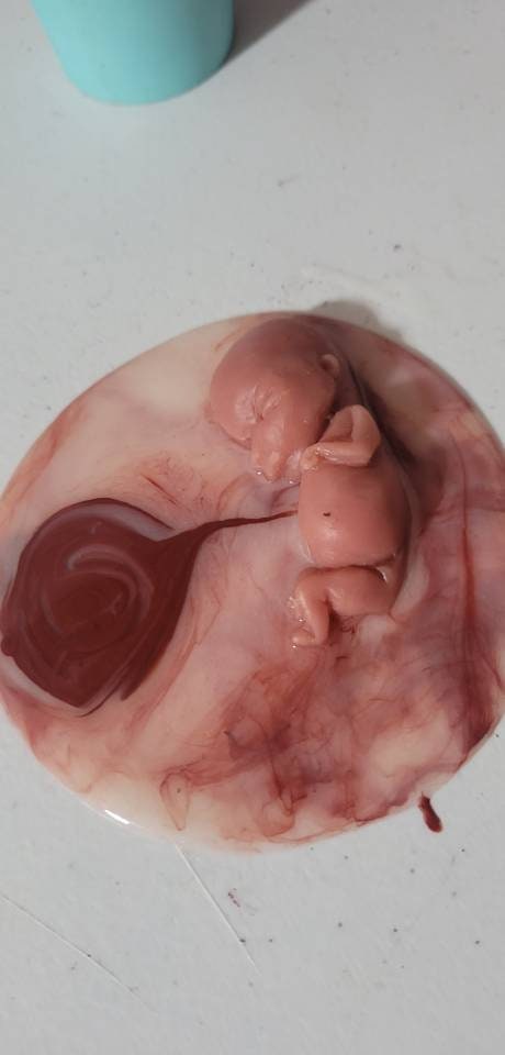 12 week gestational fetus silicone memorial baby inside silicone womb with placenta attached