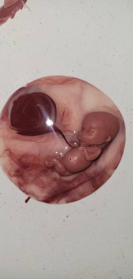 12 week gestational fetus silicone memorial baby inside silicone womb with placenta attached