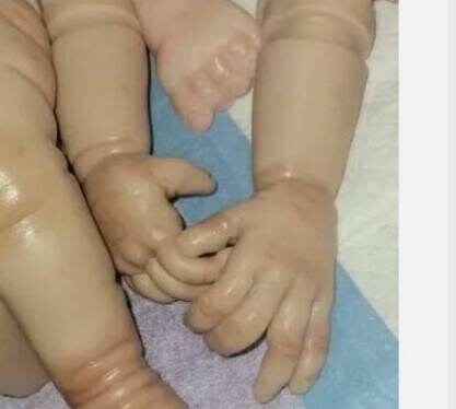 Silicone baby limbs partial limbs with, feet and open hands