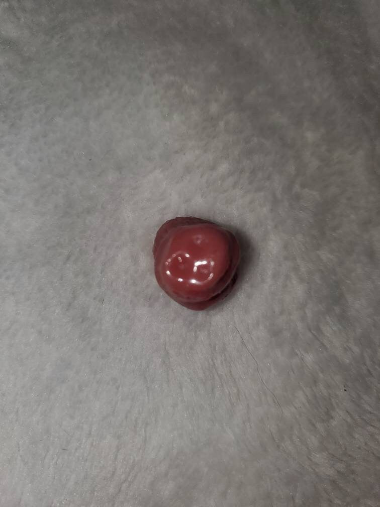 Silicone baby umbilical cord clump