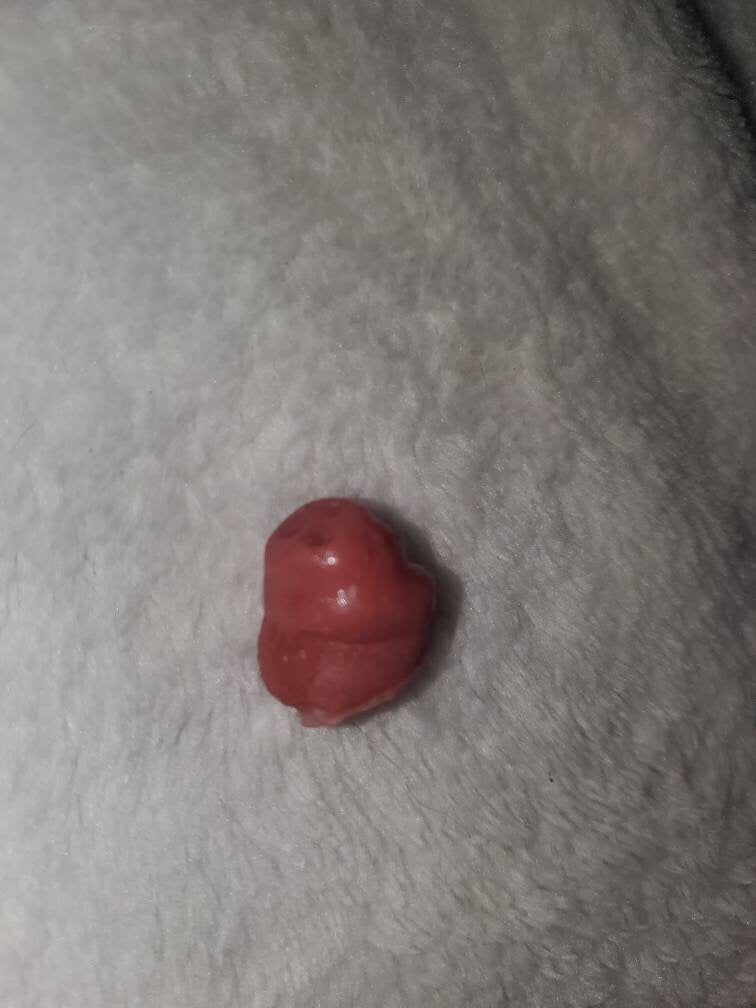 Silicone baby umbilical cord clump