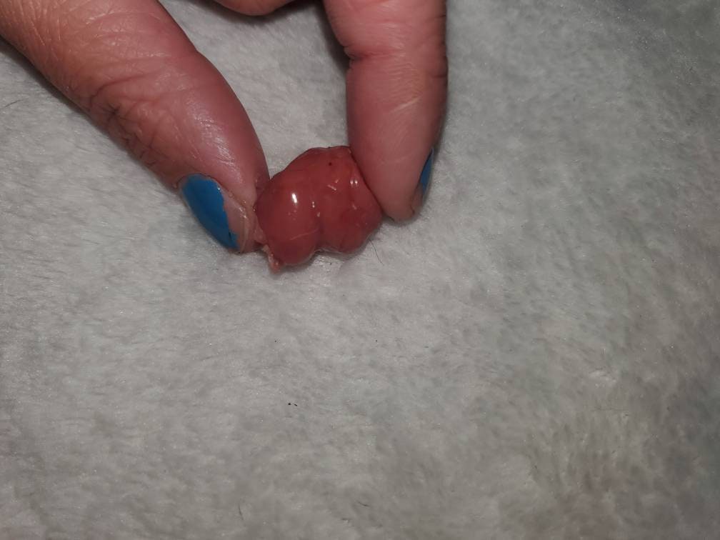 Silicone baby umbilical cord clump