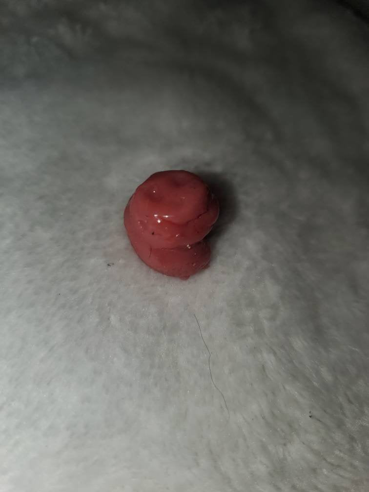 Silicone baby umbilical cord clump