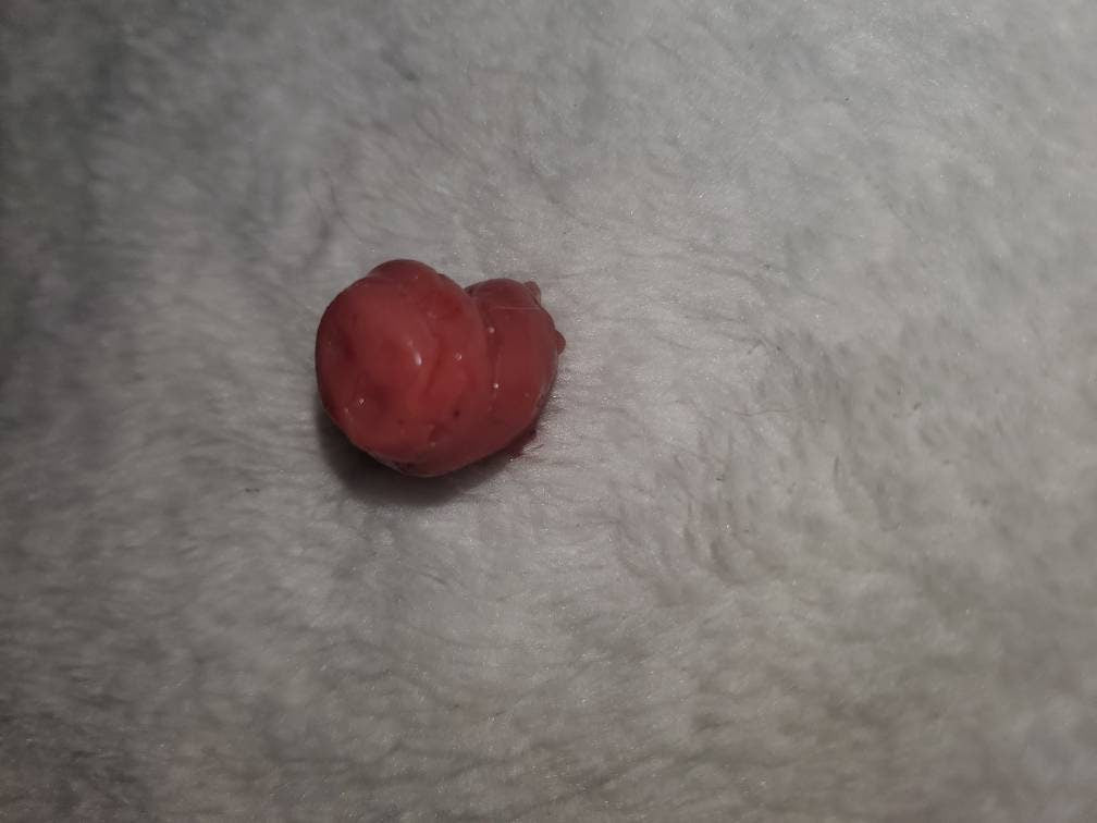 Silicone baby umbilical cord clump