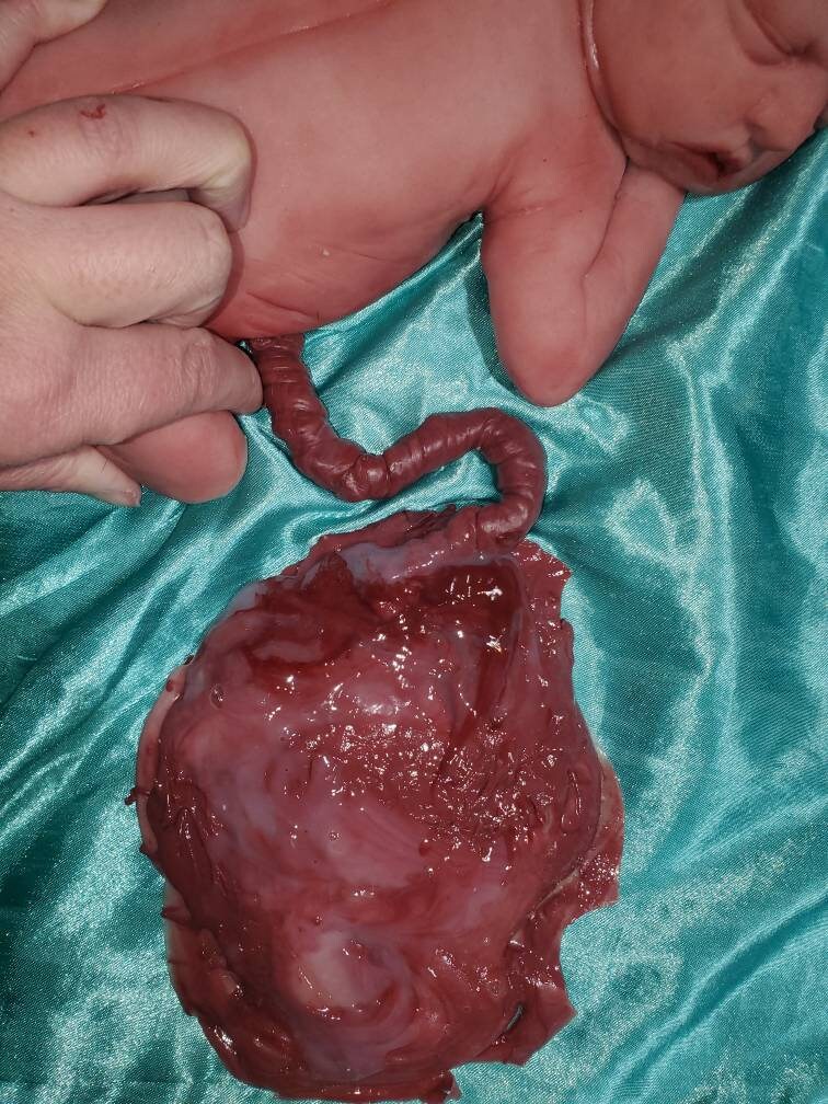 warning graphic** Silicone placenta and umbilical cord for silicone baby