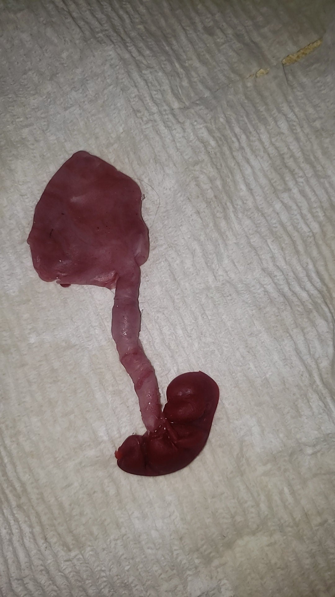 fetus silicone baby memorial with umbilical cord attached