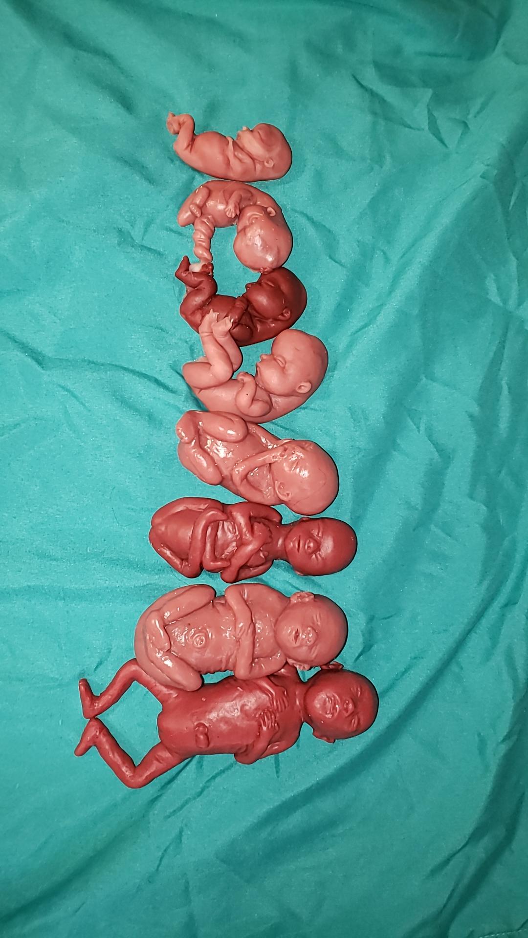 Silicone baby fetus LOT pro life developmental bundle of babies