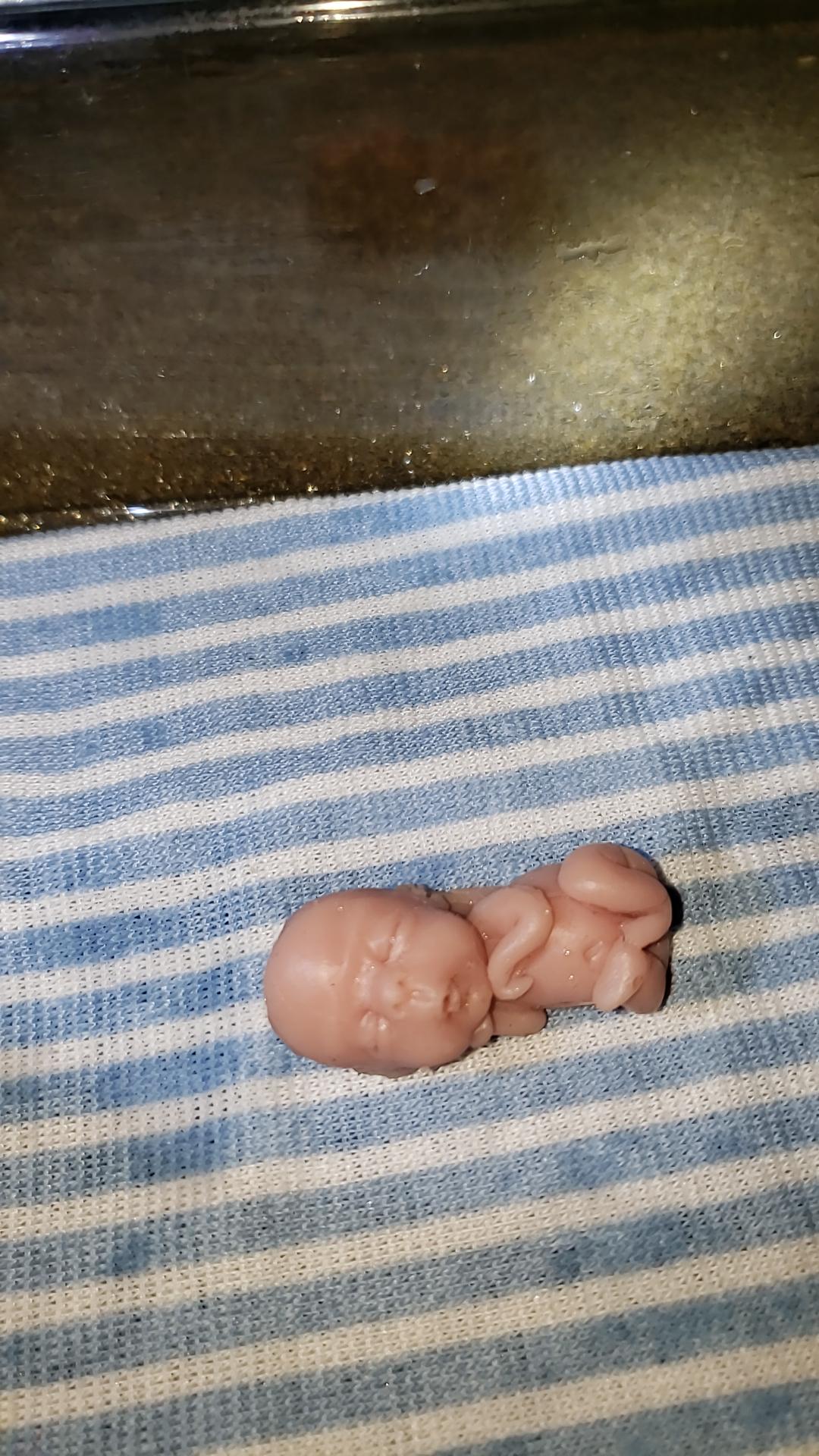 11 week gestational fetus silicone baby