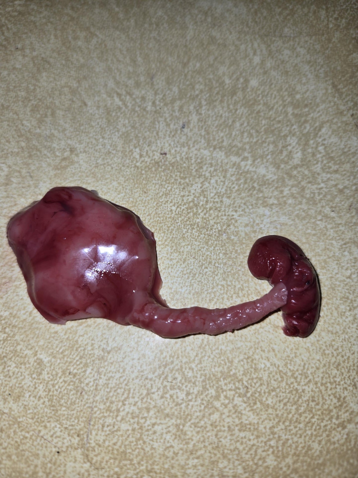 Silicone fetus with placenta and umbilical cord