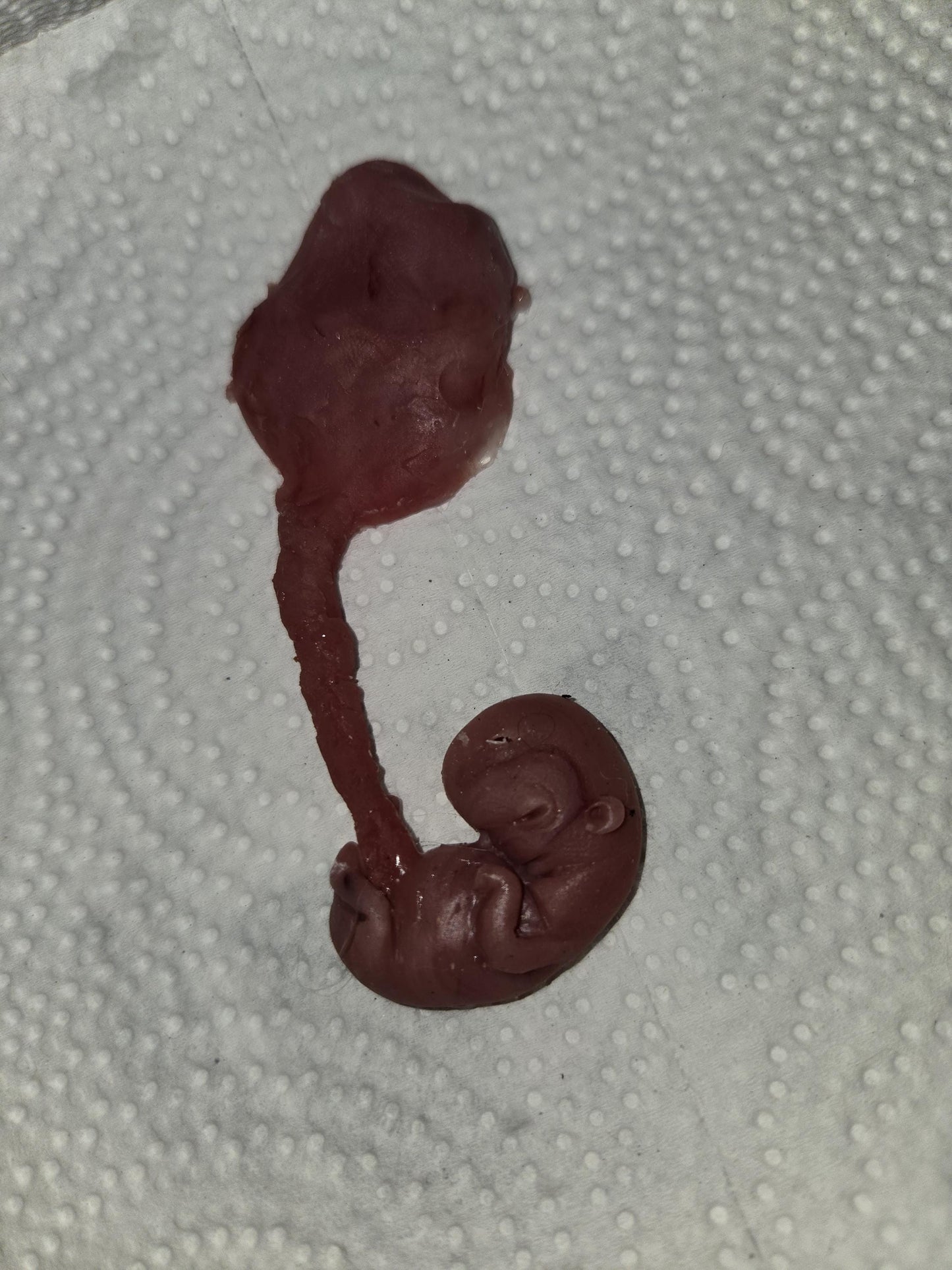Silicone fetus with placenta and umbilical cord