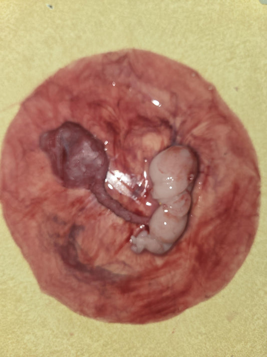 Warning graphic 12 week gestational fetus silicone memorial baby inside silicone womb with placenta attached