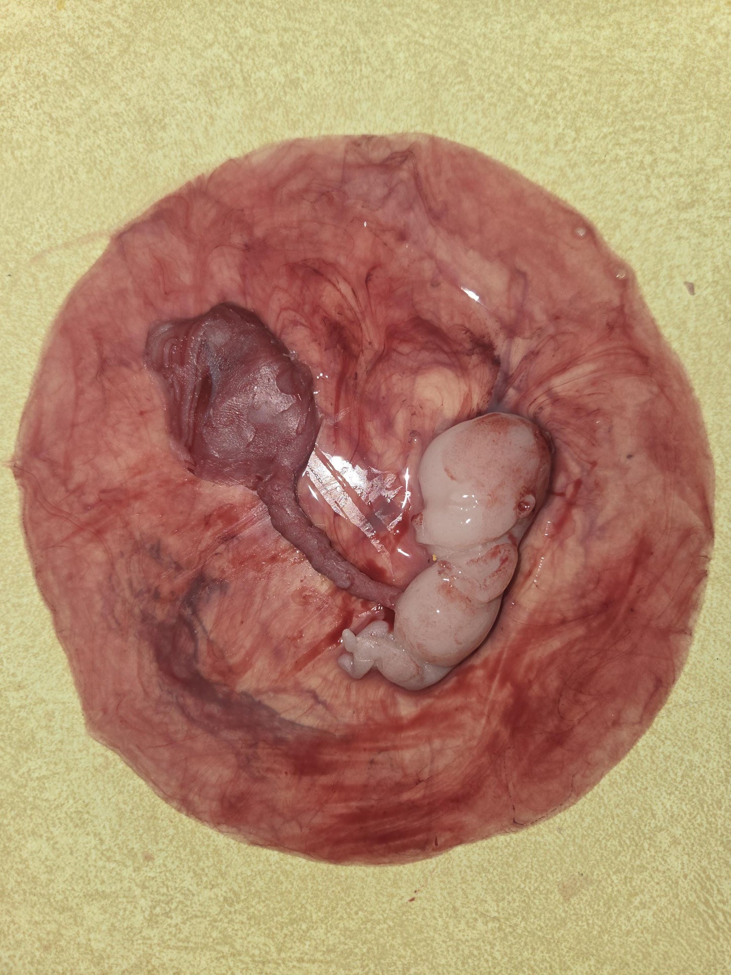 Warning graphic 12 week gestational fetus silicone memorial baby inside silicone womb with placenta attached
