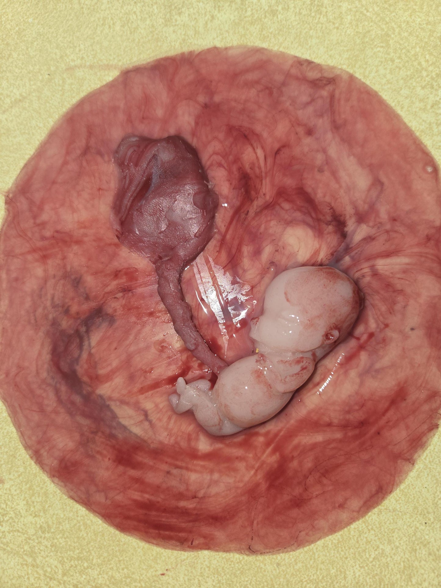 Warning graphic 12 week gestational fetus silicone memorial baby inside silicone womb with placenta attached