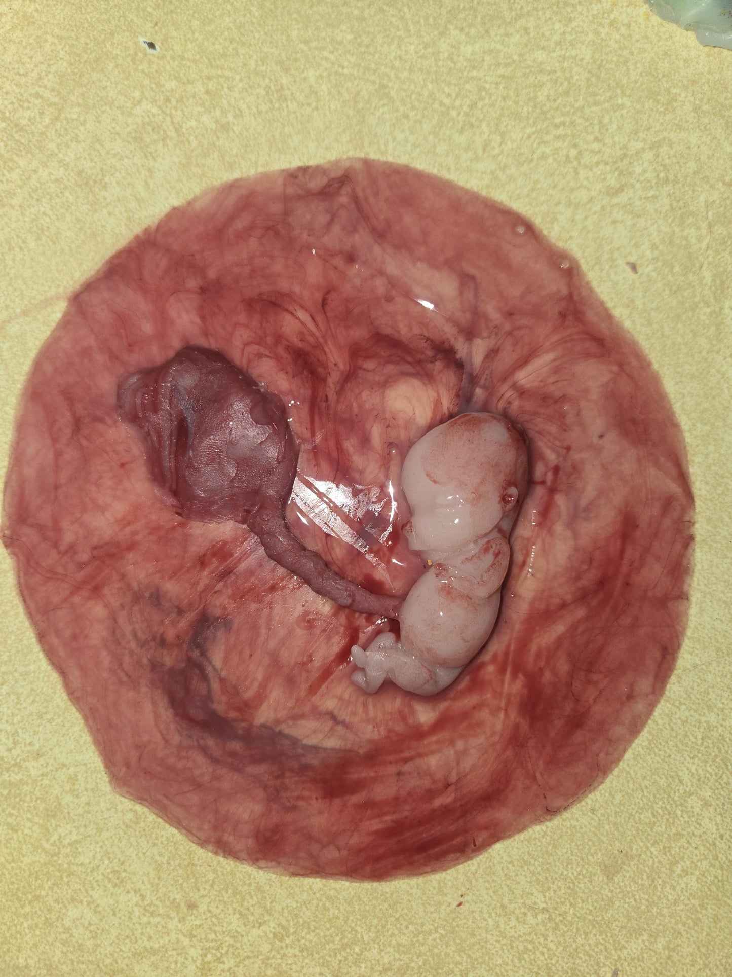 Warning graphic 12 week gestational fetus silicone memorial baby inside silicone womb with placenta attached